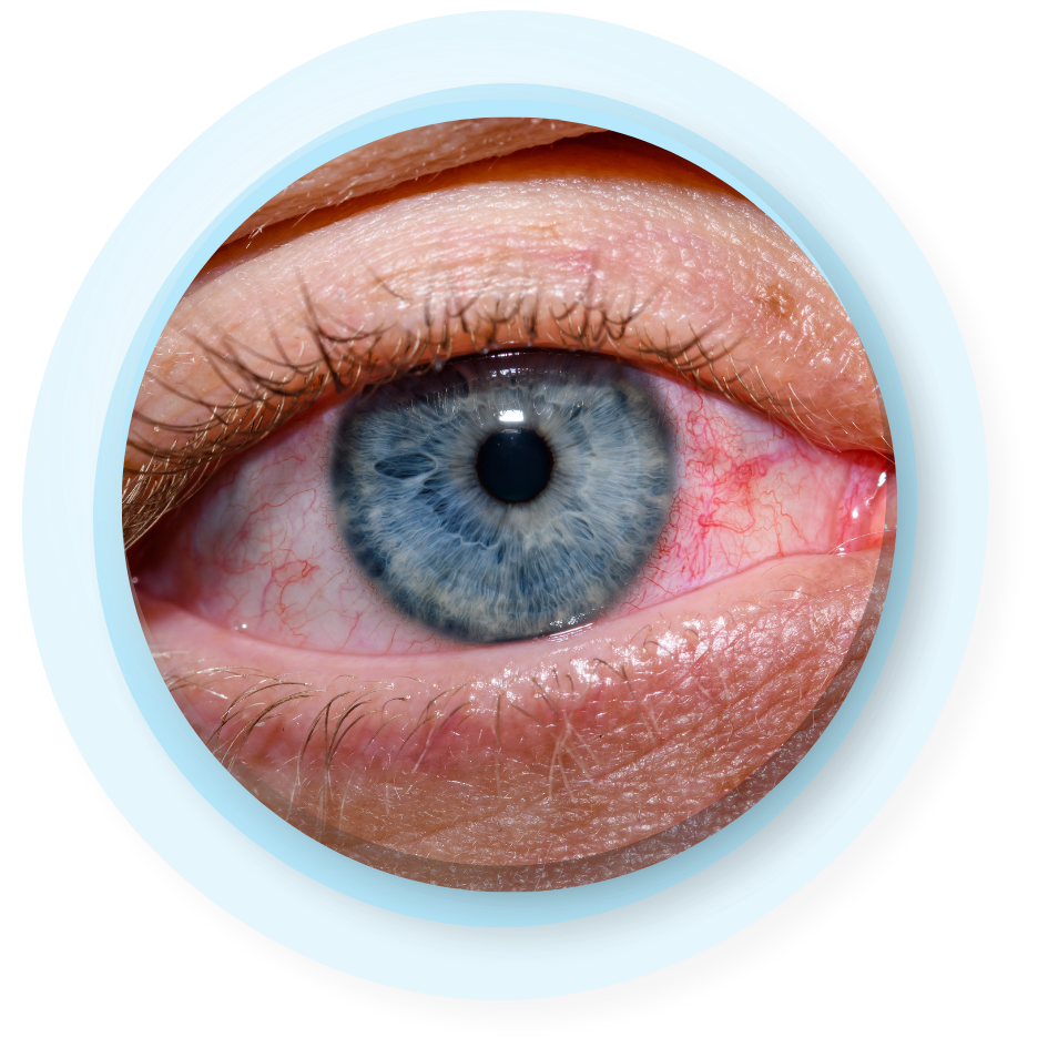 Top-rated eye hospital in Noida for cataract surgery